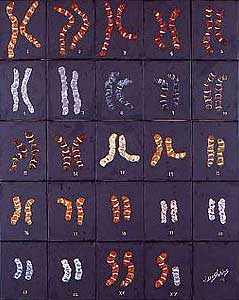 Metal human chromosomes #1 - Chromosomes humains métal #1