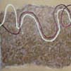 Diptych : DNA strand #1-#2 - Diptyque : Noeud ADN #1-#2